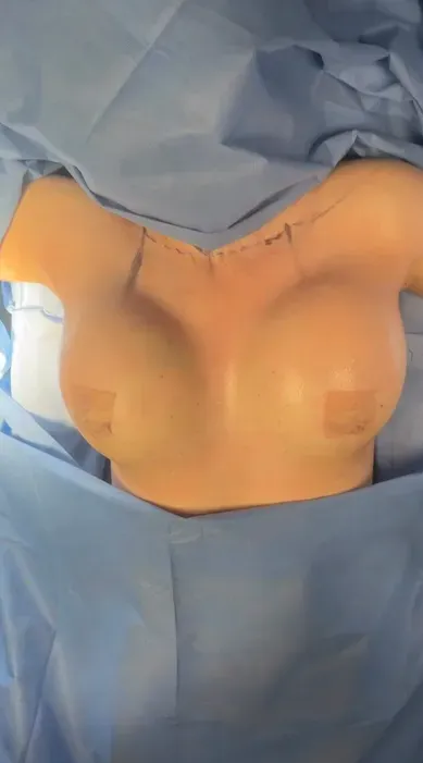 Después - Transformación